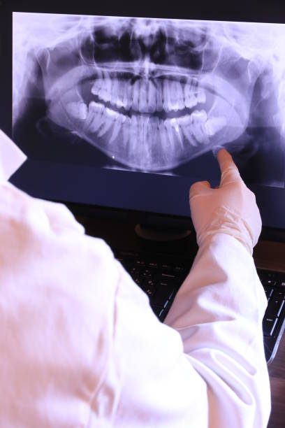 Best Emergency Dental Care for Broken or Chipped Teeth in Fredericktown, OH