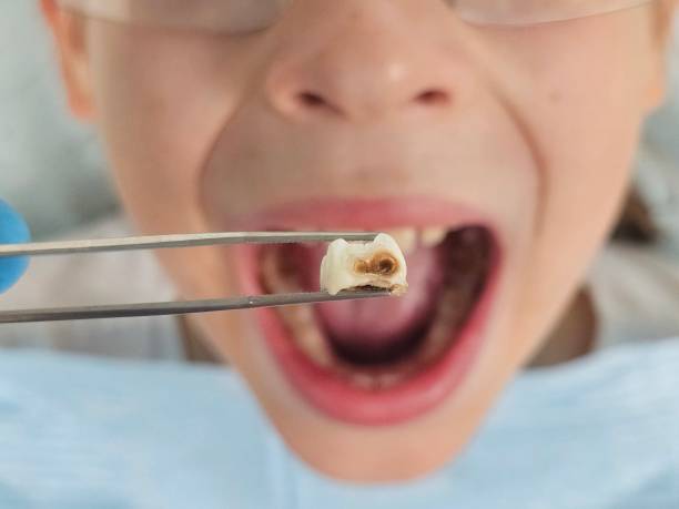 Best Emergency Denture Repair in Fredericktown, OH